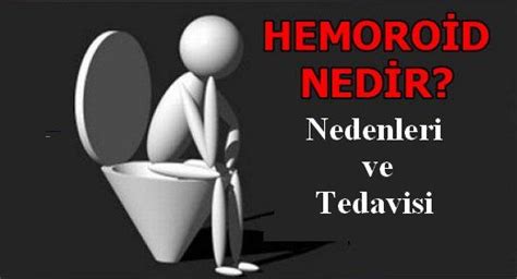 Hemoroid Nedir Basur Neden Olur Belirtileri Ve Tedavisi