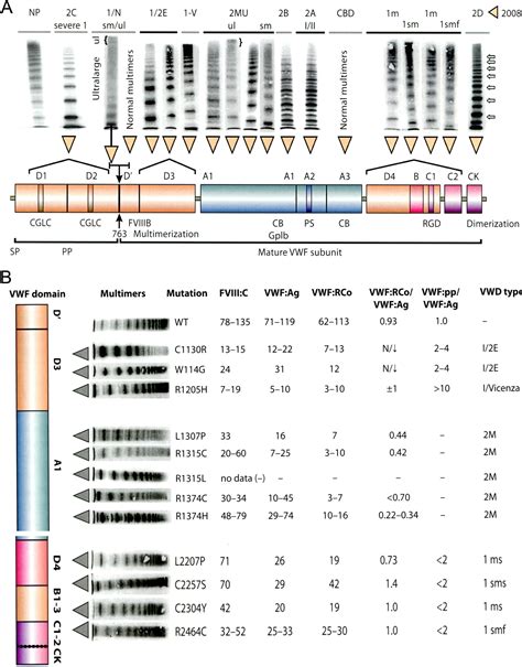 Diagnostic Differentiation Of Von Willebrand Disease Types 1 And 2 By Von Willebrand Factor