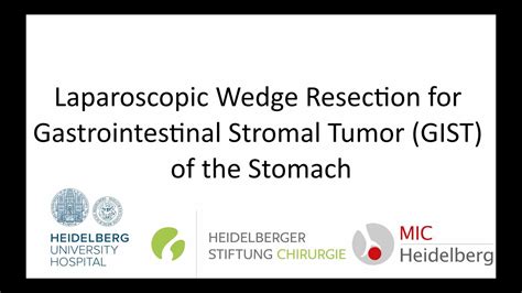 Laparoscopic Wedge Resection Of A Gastrointestinal Stromal Tumor GIST