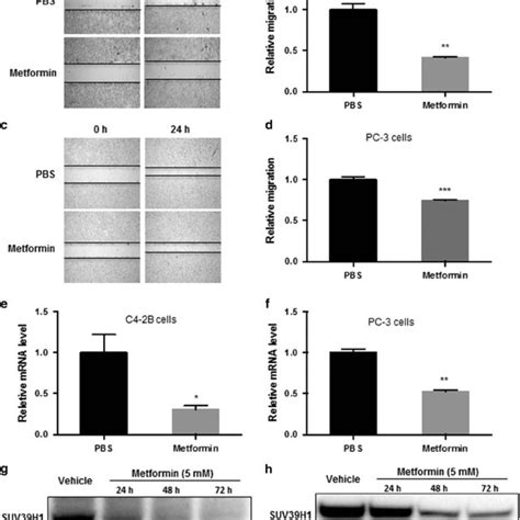 Metformin Decreases The Migration Of Pca Cells Associated With The