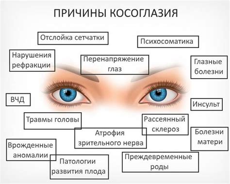 Косоглазие: Виды, причины, симптомы, диагностика, лечение