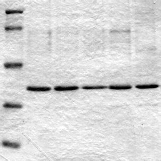 Sds Page Of The Wild Type And Mutant Lvr Enzymes Each Lane Was Loaded