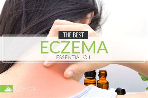 The Best Essential Oil for Eczema and Dry Skin