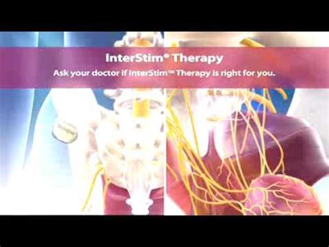 interstim overview - YouTube