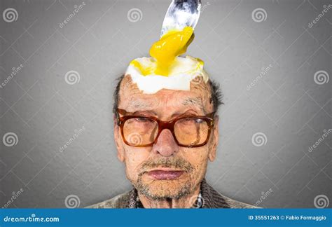 Egg Head Stock Photos - Image: 35551263