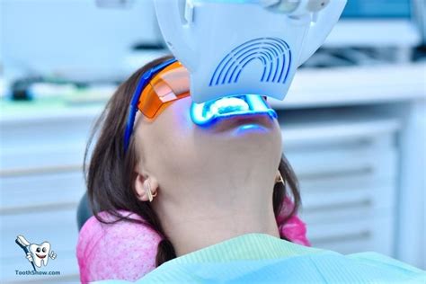 Laser Teeth Lightening Vs Expert Lightening Trays