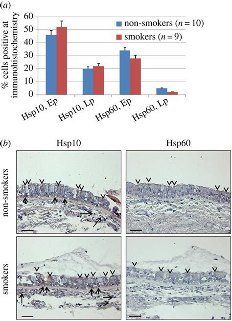 Immunohistochemical Detection Of Hsp10 And Hsp60 In Human Bronchial