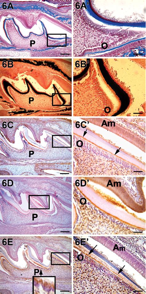 Temporal And Spatial Localization Of The Dentin Matrix Proteins During