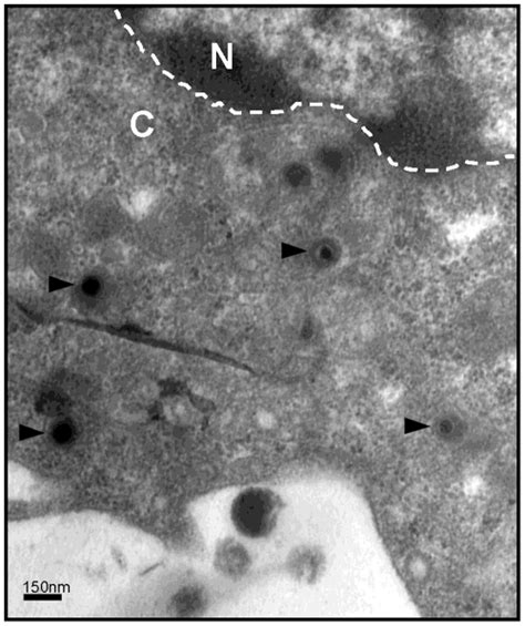 Transmission Electron Microscopy Tem Picture Of A Day Immature Mddc