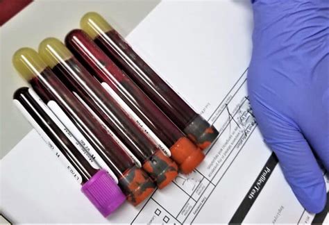 How To Get A Phlebotomy Certification Step By Step Guide 2024