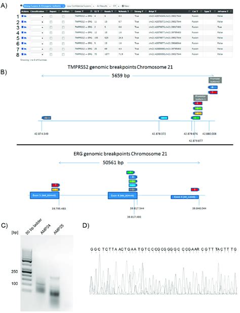 Representative Results For An Identified Tmprss Erg Fusion Case