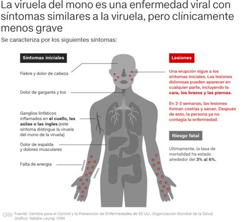 Qu S Ntomas Causa La Viruela Del Mono C Mo Se Contagia Y Qu