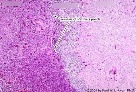 Pituitary Histology Pituitary Gland Histology Slide | Sexiz Pix