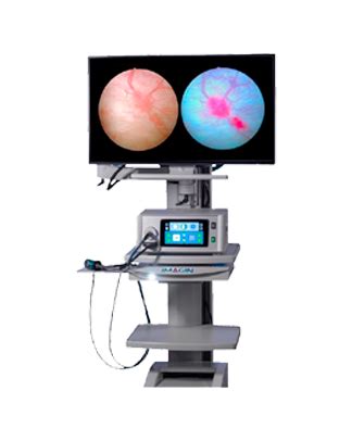 Bladder Cancer Blue Light Cystoscopy Imagin Medical