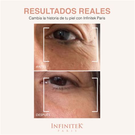 Multi Active Contorno De Ojos Mejora Bolsas Ojeras Y Arrugas