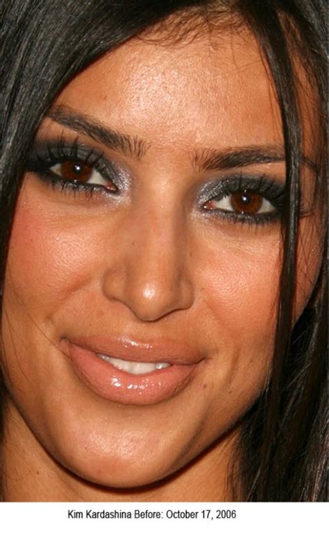 Kim Kardashian Nose job