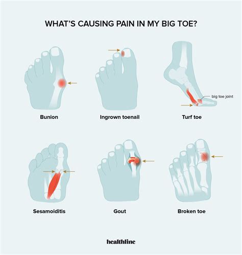 Injured Big Toe Joint