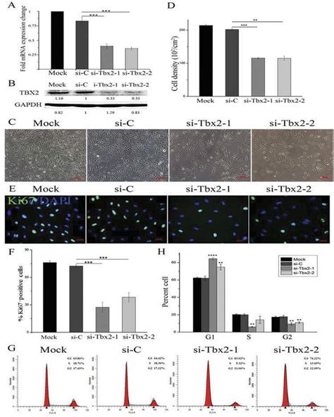 Knockdown Of TBX2 Inhibits ARPE 19 Cell Proliferation A