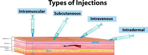 Types Of Injection Sites