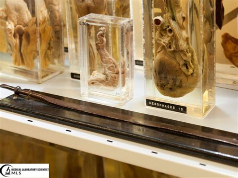 fixation ideal fixative factors involved  fixation medical