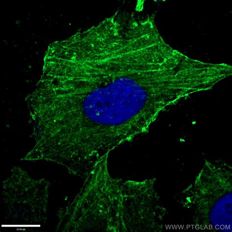 beta Actin Antibody (66009-1-IG)