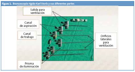 Broncoscopia Pedi Trica Una Realidad Til Y Segura