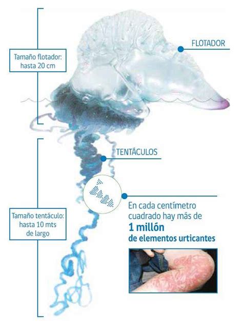 Fragata Portuguesa Qué debo hacer si me pica Cómo reconocerla Qué