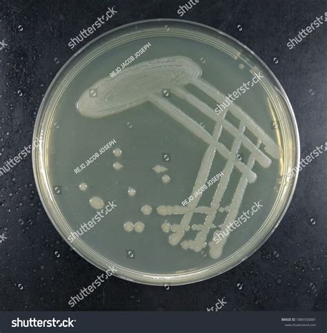 Pseudomonas Aeruginosa Colonies Nutrient Agar Stock Photo