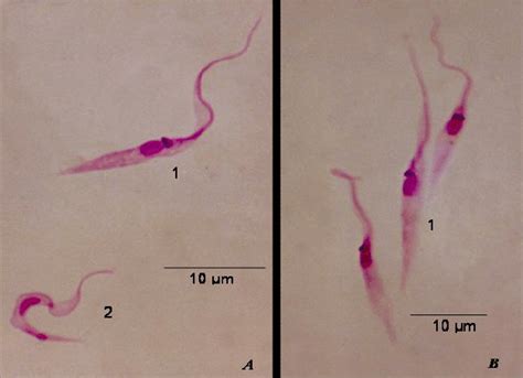 Trypanosoma Cruzi Epimastigote