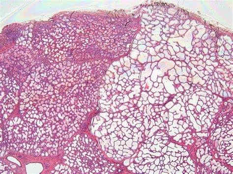 Lactating Mammary Gland Histology X Anatomicum