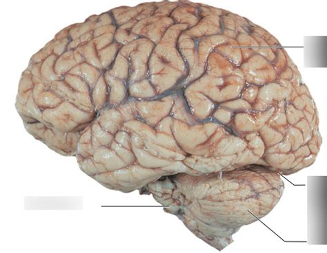 Left Lateral View Of Brain Diagram Quizlet