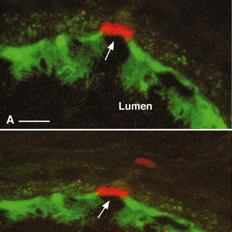 Confocal Microscopy Showing Double Immunofluorescence Labeling For Nhe3