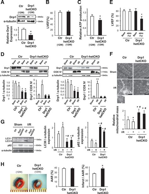 Endogenous Drp1 Mediates Mitochondrial Autophagy And Protects The Heart