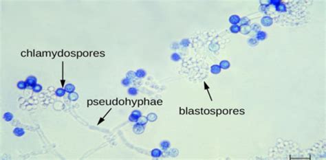 Mycology Exam 3 Flashcards Quizlet