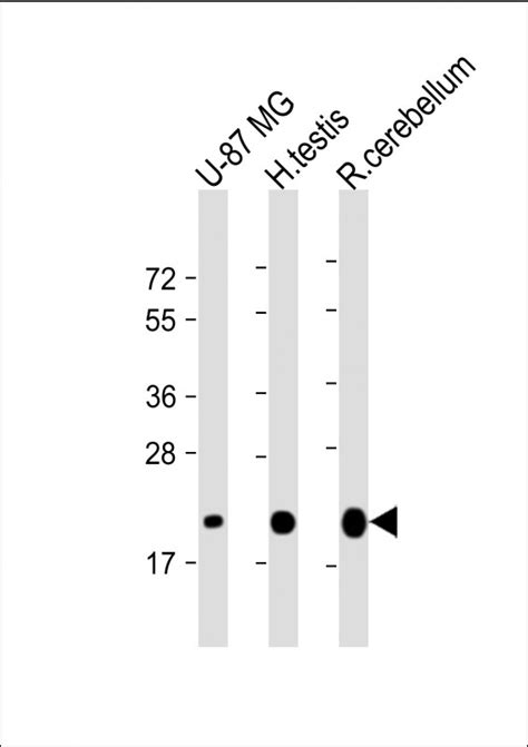 Cd Antibody Purified Mouse Monoclonal Antibody Mab Wb E Buy Now