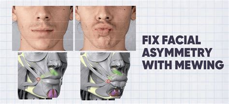 How To Fix Facial Asymmetry With Mewing Mewing Coach