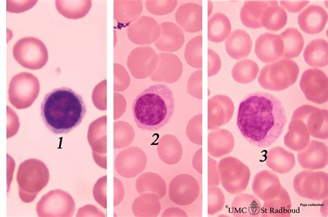 Lymphocytes Drbeckmann