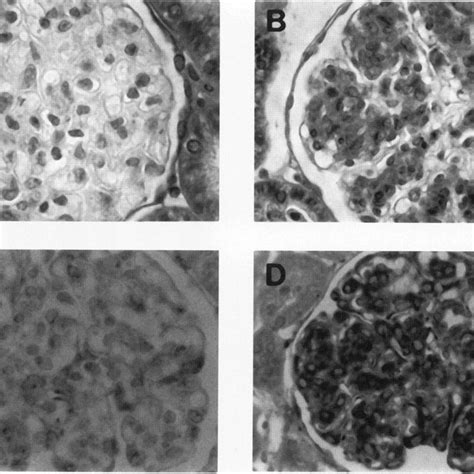 Pdf Sparc Is Expressed By Mesangial Cells In Experimental Mesangial