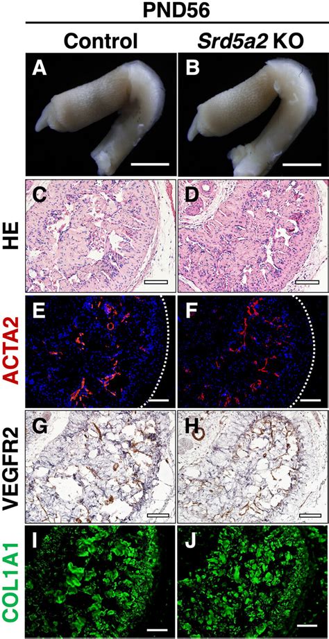 Histological And Immunofluorescence Analysis Of Exg Between Controls