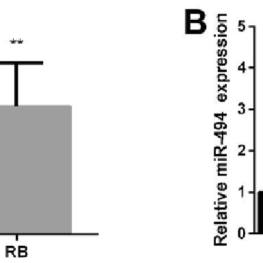 Upregulation Of MiR494 In RB Tissue Samples A Average Expression