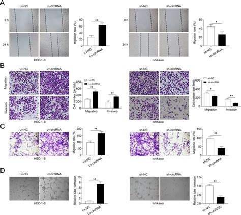 Effect Of Hsa Circ 0002577 On EC Cell Migration Invasion HEC 1 B And