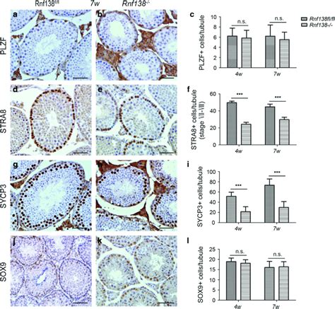 Knockout Of Rnf138 Decreases The Differentiating Spermatogonia A B