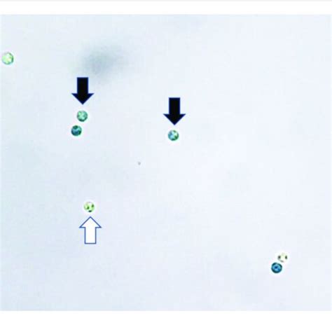 Plasmodiophora Brassicae Resting Spores Stained With Evans Blue