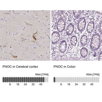 Regulation Of Response To Stress Pathway Bioinformatics Novus Biologicals