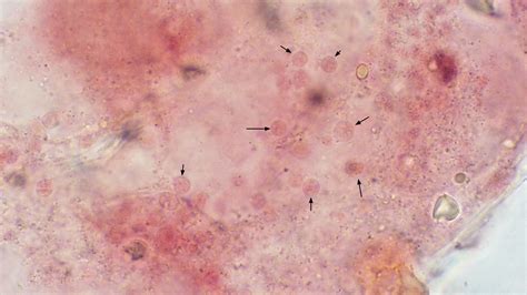 Plasmodial Slime Mold Microscope