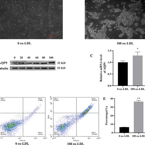 Ox LDL Induced AQP9 And Cell Apoptosis In HUVECs A Cells Were Treated