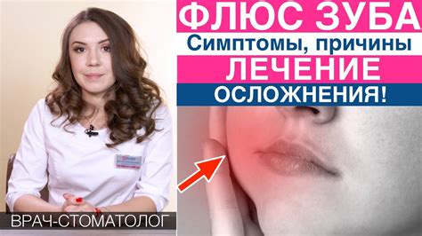 Флюс Зуба Фото — Картинки фотографии