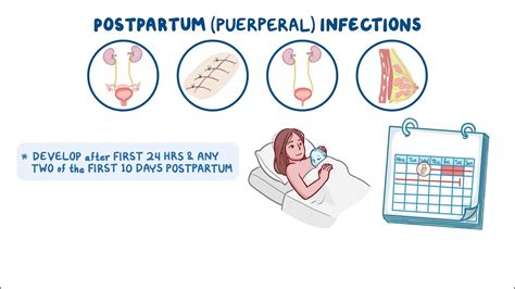 Postpartum Infections Nursing Osmosis Video Library