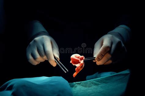 Closeup Surgical Team Performing Surgery To Patient in Sterile ...