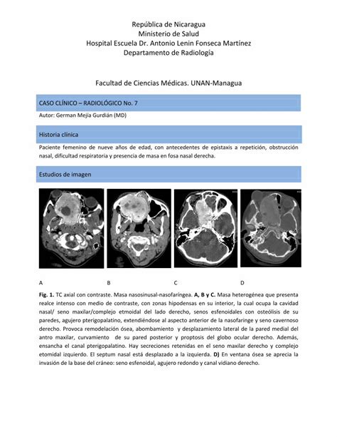 PDF República de Nicaragua Ministerio de Salud Hospital nicarad